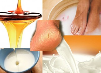 គ្រាន់តែឱសថប្រើទឹកឃ្មុំអាចធ្វើឱ្យកែងជើងអ្នករលោងល្អ!!/TRY THIS SIMPLE HONEY REMEDY AND HAVE BEAUTIFUL SMOOTH HEELS!!