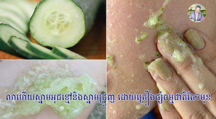 លាហើយស្នាមអុជខ្មៅនិងស្នាមជ្រួញ ដោយគ្រឿងផ្សំធម្មជាតិតែ3មុខ