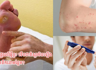 អាចញ៉ាំផ្លែឈើអ្វីខ្លះ ទើបជាតិស្ករមិនឡើង សំរាប់អ្នកទឹកនោមផ្អែម?