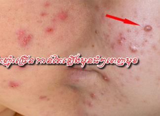 អាហារ នេះកាន់តែញុំាច្រើន កាន់តែឡើងមុនធំៗពេញមុខ!